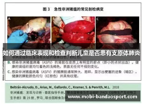 如何通过临床表现和检查判断儿童是否患有支原体肺炎